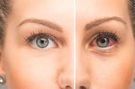 Eye Health Matters Too! Let’s Talk About Dry Eye, Cataracts, and More — From the Experts You Trust
